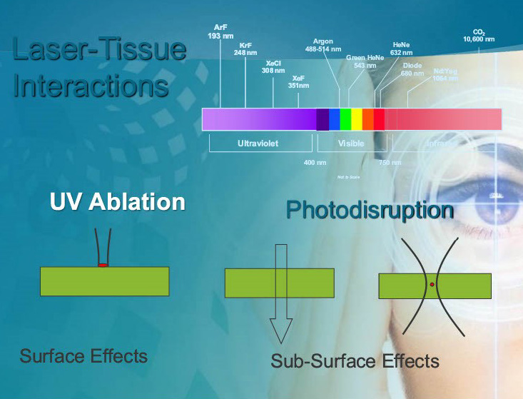 laser-tissue interactions