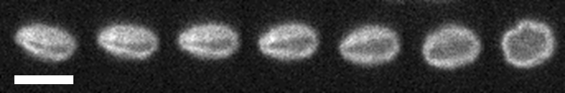 kinetoplast flowing in a microfluidic channel. Its shape cha